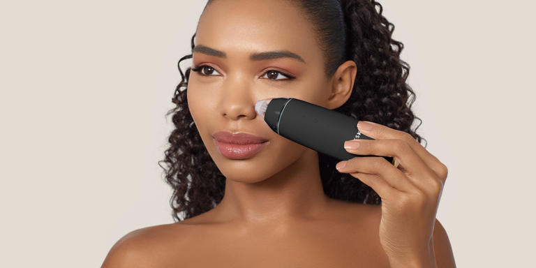 medium_geske_microdermabrasion
